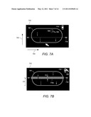 Displaying Computer-Aided Detection Information With Associated Breast Tomosynthesis Image Information diagram and image