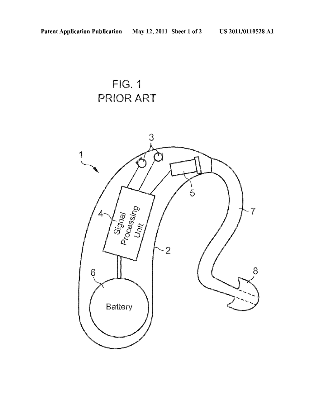 HEARING DEVICE WITH SIMULATION OF A HEARING LOSS AND METHOD FOR SIMULATING A HEARING LOSS - diagram, schematic, and image 02