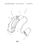 METHOD OF COATING A HEARING AID COMPONENT AND A HEARING AID COMPRISING A COATED COMPONENT diagram and image