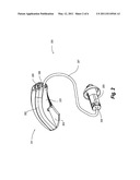 METHOD OF COATING A HEARING AID COMPONENT AND A HEARING AID COMPRISING A COATED COMPONENT diagram and image