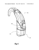 METHOD OF COATING A HEARING AID COMPONENT AND A HEARING AID COMPRISING A COATED COMPONENT diagram and image