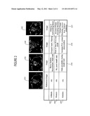System for Dynamically Improving Medical Image Acquisition Quality diagram and image