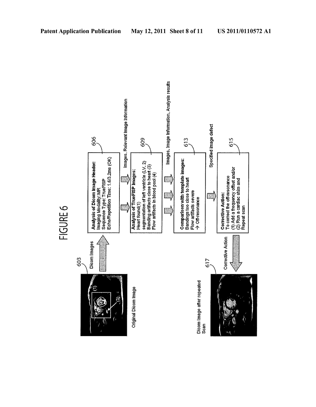 System for Dynamically Improving Medical Image Acquisition Quality - diagram, schematic, and image 09