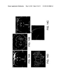 Functionalized Magnetic Nanoparticles and Methods of Use Thereof diagram and image