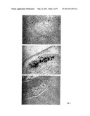 BMP-7 FOR USE IN TREATING VASCULAR SCLEROSIS diagram and image