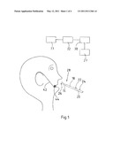 METHOD FOR DETERMINING 3D DATA FROM AT LEAST ONE PREPARED MAXILLARY AREA diagram and image