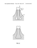 DENTAL IMPLANT diagram and image