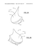 BRA AND/OR BRA PAD FOR PROVIDING THE APPEARANCE OF SYMMETRY TO ASYMMETRICAL BREASTS diagram and image
