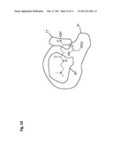 PEGYLATED RECOMBINANT HUMAN GROWTH HORMONE COMPOUNDS diagram and image