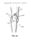 APPARATUS AND METHOD FOR ELECTROMAGNETIC TREATMENT diagram and image