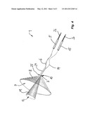 ENDOSCOPE SET diagram and image