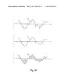 Devices and methods for monitoring physiological information relating to sleep with an implantable device diagram and image