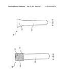 Nail Locking Systems diagram and image