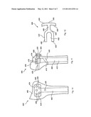 Nail Locking Systems diagram and image