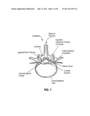 TISSUE MODIFICATION DEVICES diagram and image