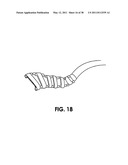 TISSUE MODIFICATION DEVICES diagram and image