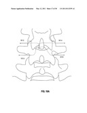 TISSUE MODIFICATION DEVICES diagram and image