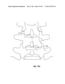 TISSUE MODIFICATION DEVICES diagram and image