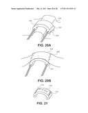 TISSUE MODIFICATION DEVICES diagram and image