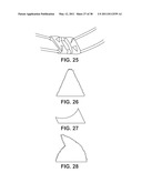 TISSUE MODIFICATION DEVICES diagram and image