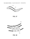 TISSUE MODIFICATION DEVICES diagram and image