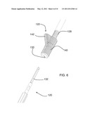 FEMORAL REAMING SYSTEM AND METHOD OF PERFORMING TRIAL REDUCTION diagram and image