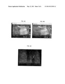 ULTRASOUND GUIDED ROBOT FOR FLEXIBLE NEEDLE STEERING diagram and image