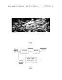 ULTRASOUND GUIDED ROBOT FOR FLEXIBLE NEEDLE STEERING diagram and image