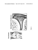 DEVICES, SYSTEMS AND METHODS FOR MENISCUS REPAIR diagram and image