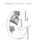 DEVICES, SYSTEMS AND METHODS FOR MENISCUS REPAIR diagram and image