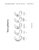 DEVICES, SYSTEMS AND METHODS FOR MENISCUS REPAIR diagram and image