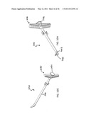 DEVICES, SYSTEMS AND METHODS FOR MENISCUS REPAIR diagram and image