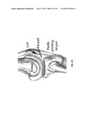 DEVICES, SYSTEMS AND METHODS FOR MENISCUS REPAIR diagram and image