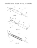 SURGICAL COMPRESSION CLIPS diagram and image