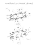 SURGICAL COMPRESSION CLIPS diagram and image