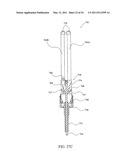 SURGICAL COMPRESSION CLIPS diagram and image