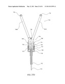 SURGICAL COMPRESSION CLIPS diagram and image