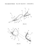 SURGICAL COMPRESSION CLIPS diagram and image