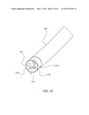 SURGICAL COMPRESSION CLIPS diagram and image