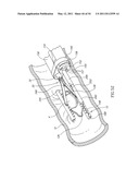 SURGICAL COMPRESSION CLIPS diagram and image