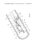 SURGICAL COMPRESSION CLIPS diagram and image