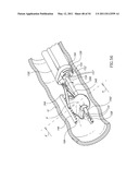 SURGICAL COMPRESSION CLIPS diagram and image