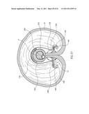 SURGICAL COMPRESSION CLIPS diagram and image