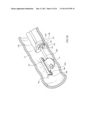 SURGICAL COMPRESSION CLIPS diagram and image