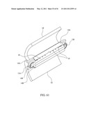 SURGICAL COMPRESSION CLIPS diagram and image