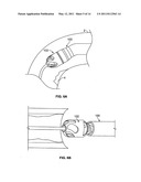 Atherectomy devices and methods diagram and image