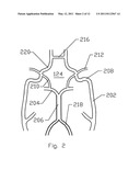 EXPANDABLE CEREBROVASCULAR SHEATH AND METHOD OF USE diagram and image