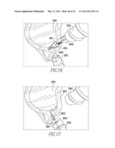 Tissue Repair Devices diagram and image