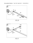 Tissue Repair Devices diagram and image