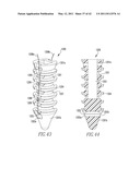 Tissue Repair Devices diagram and image